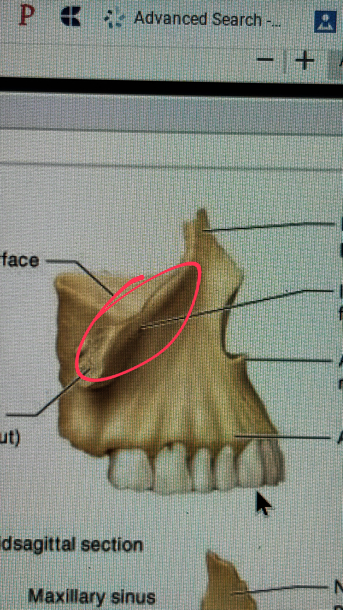 <p>just below the eye socket (orbital) hence the “infra” orbital</p>