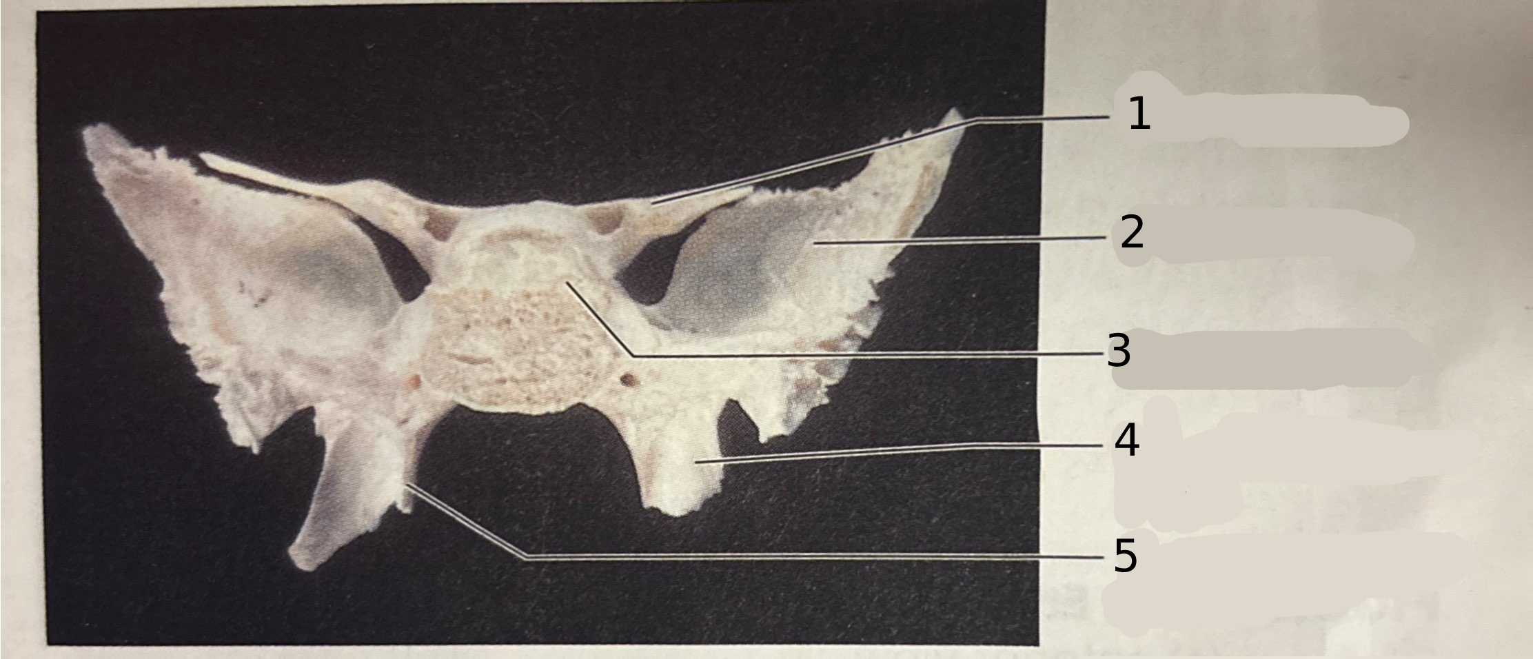 <p>What view of the bone is this?</p>