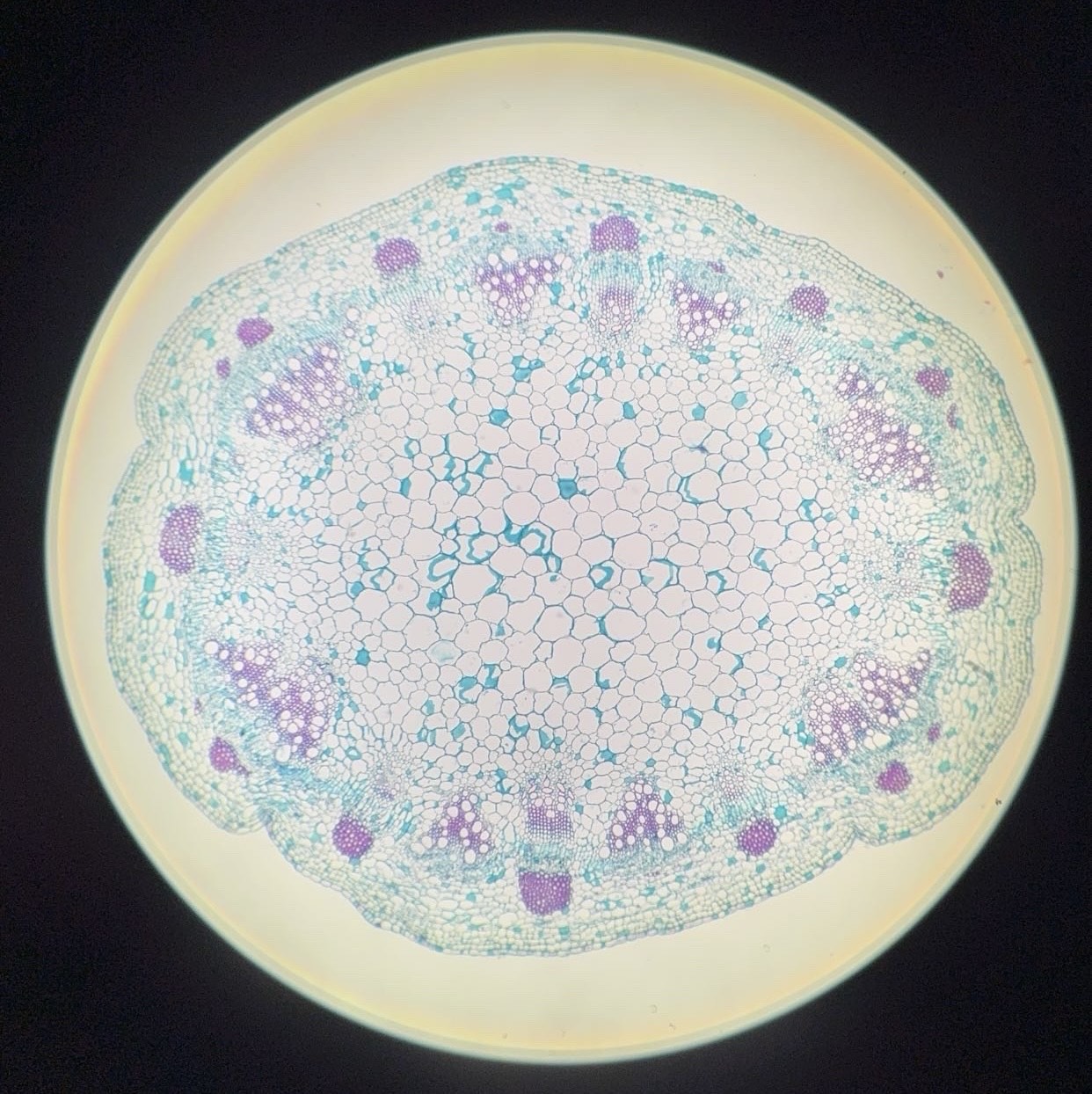 <p><span>What is this organism?</span></p>