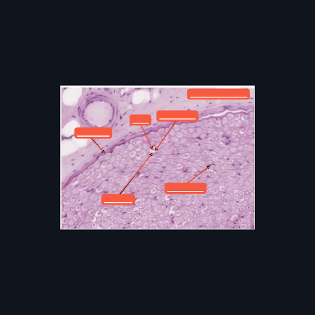 <p>Identify the pointed structures.</p>