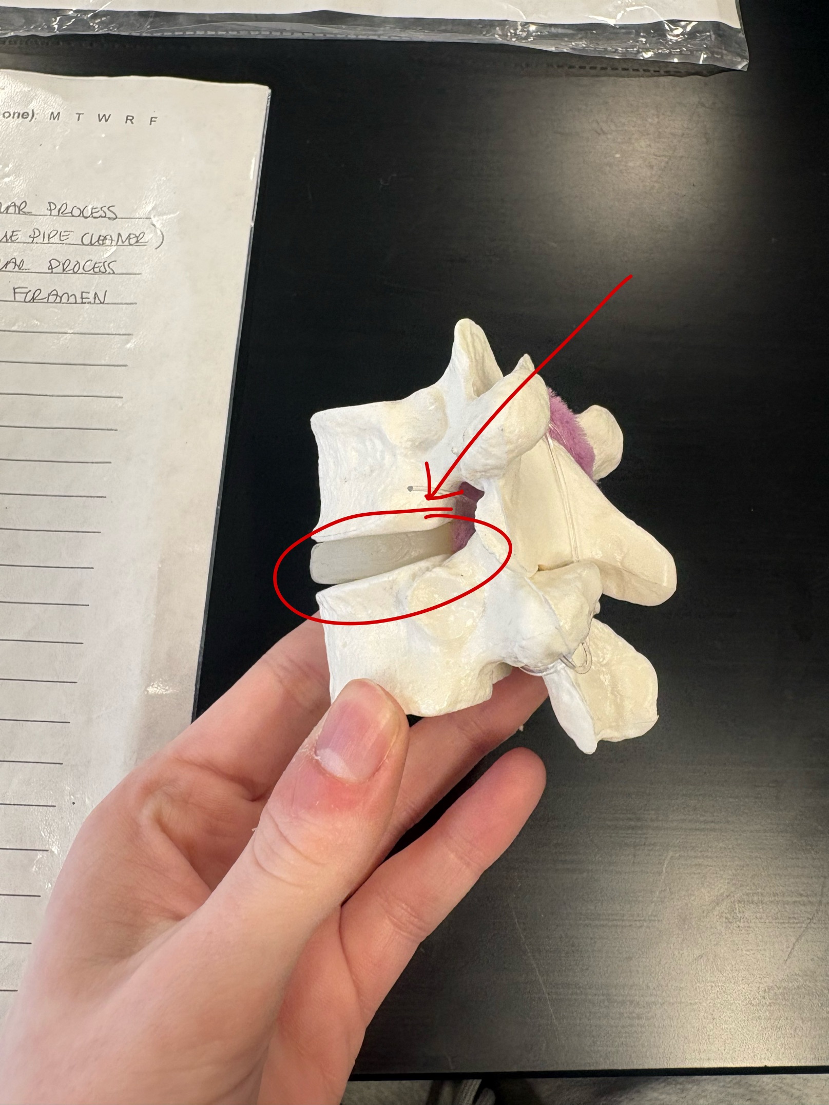 <p>Name this articulation</p>