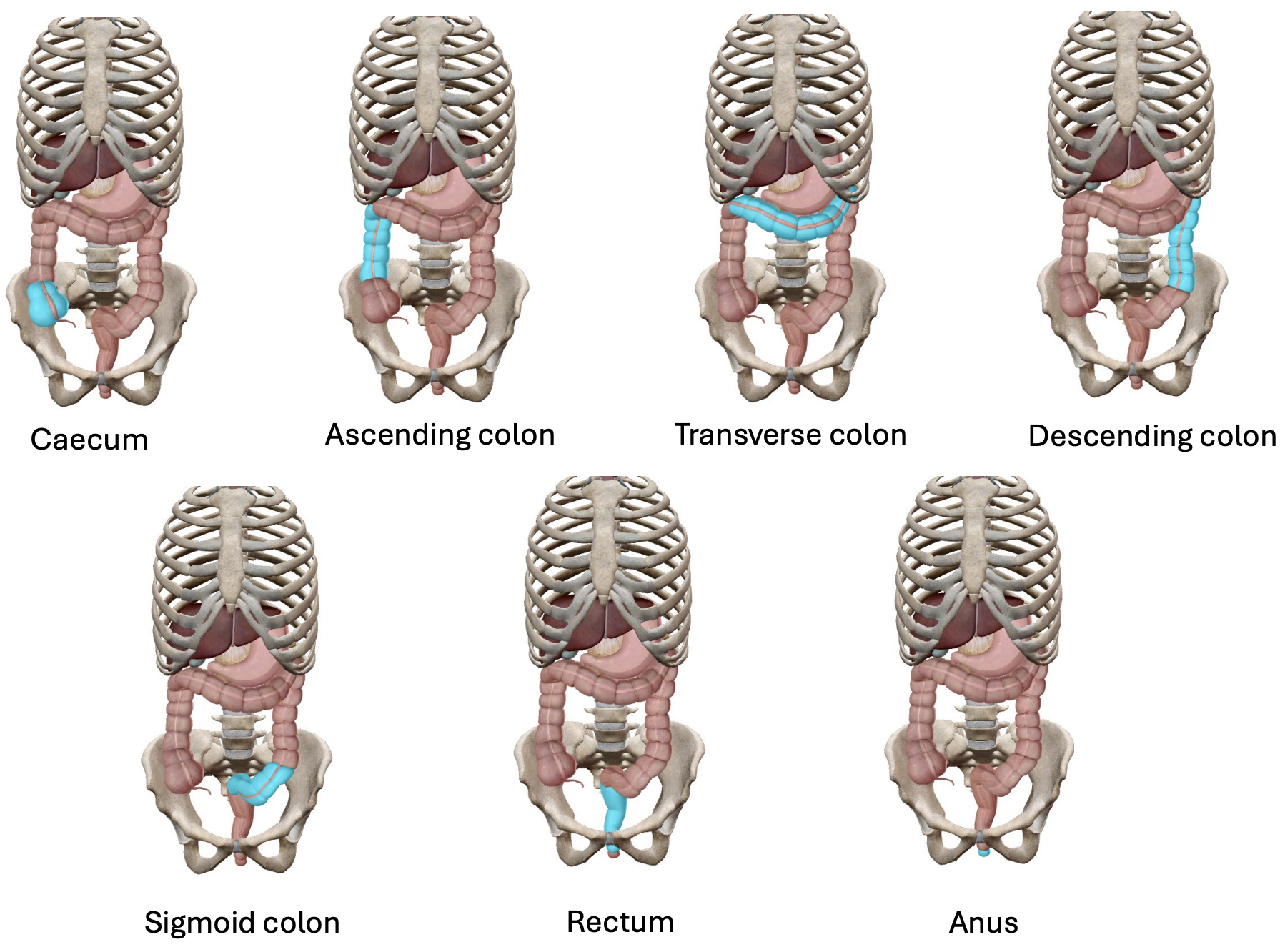 <p>6 segments:</p><ol><li><p><strong><em><u>Caecum</u></em></strong></p><ul><li><p>Right lower quadrant</p></li><li><p>Linkage of appendix</p></li></ul></li></ol><ol><li><p><strong><em><u>Ascending colon</u></em></strong></p><ul><li><p>Right upper quadrant</p></li></ul></li><li><p><strong><em><u>Transverse colon</u></em></strong></p><ul><li><p>Travels from right to left upper quadrants</p></li></ul></li><li><p><strong><em><u>Descending colon</u></em></strong></p><ul><li><p>Left upper and lower quadrants</p></li></ul></li><li><p><strong><em><u>Sigmoid colon</u></em></strong></p><ul><li><p>Left lower quadrant</p></li></ul></li><li><p><strong><em><u>Rectum</u></em></strong></p><ul><li><p>Located at the midline of both quadrants</p></li></ul></li><li><p><strong><em><u>Anus</u></em></strong></p><ul><li><p>Located at the midline of both quadrants</p></li></ul></li></ol><p></p>