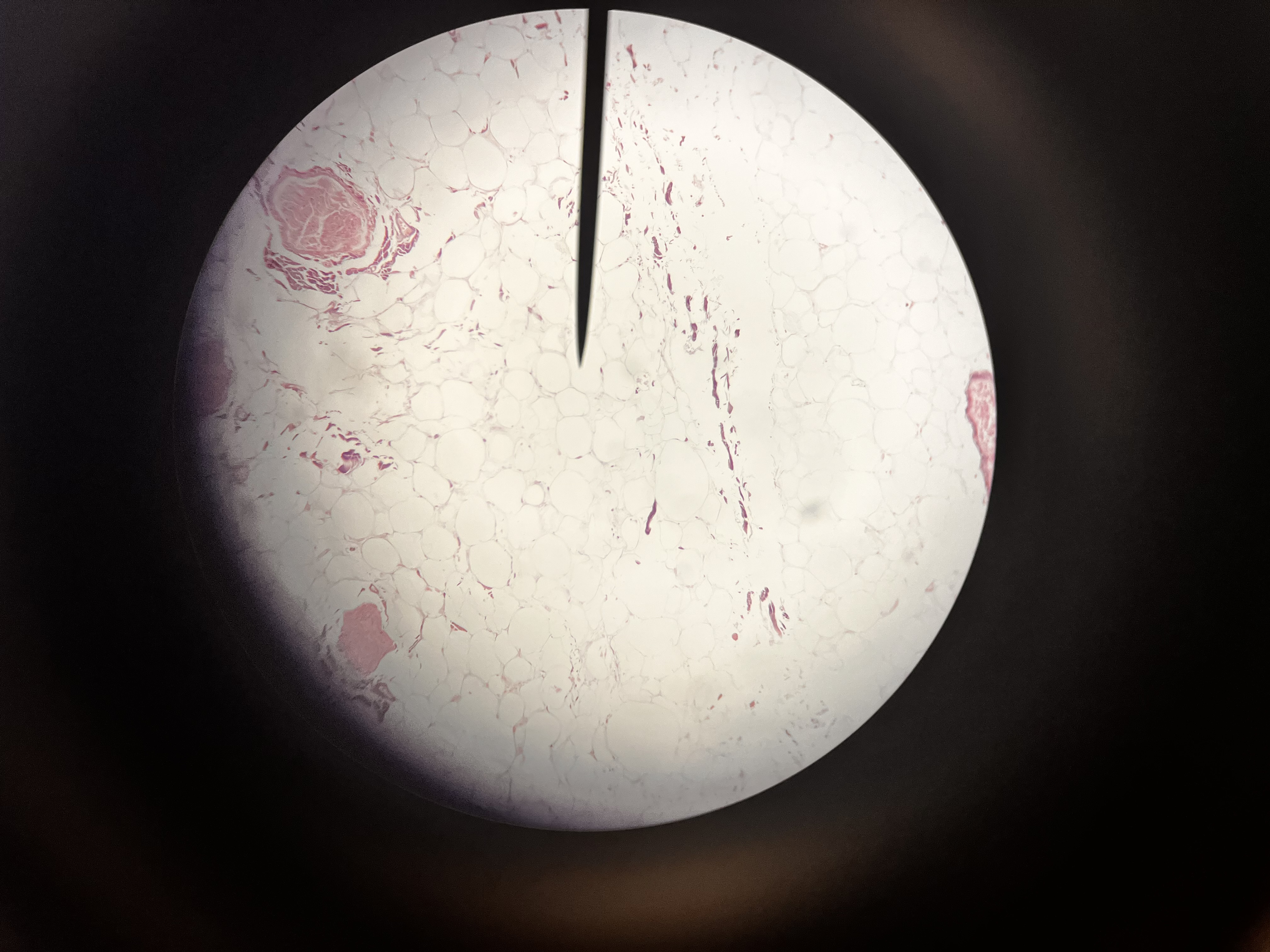 <ol><li><p>Name the substance at the tip of the pointer</p></li><li><p>Name of tissue</p></li><li><p>What is the classification of this tissue</p></li></ol>