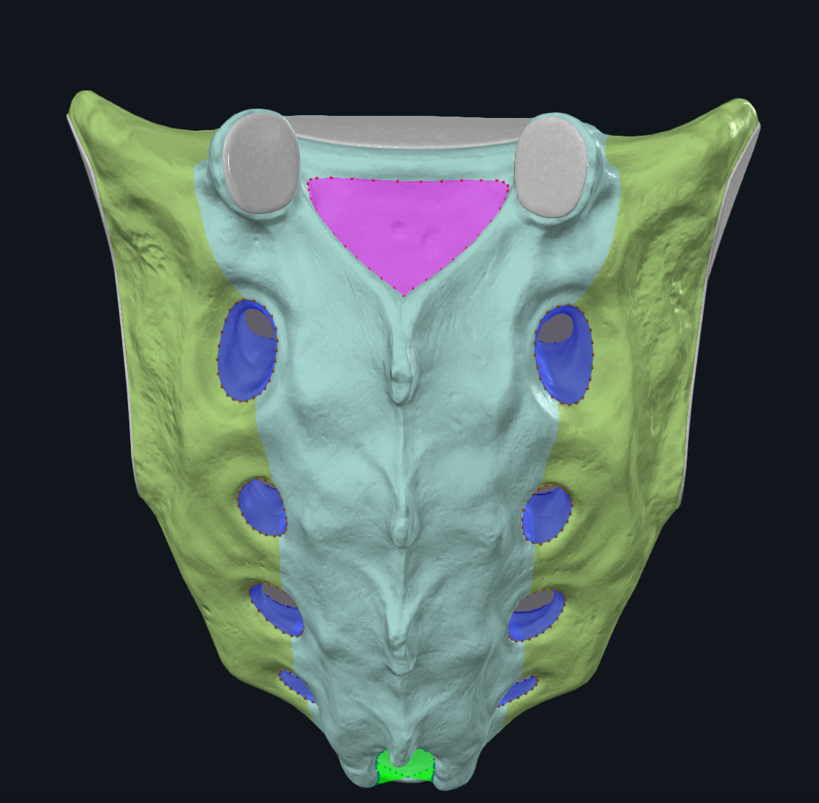 <p>Location of PURPLE:</p>
