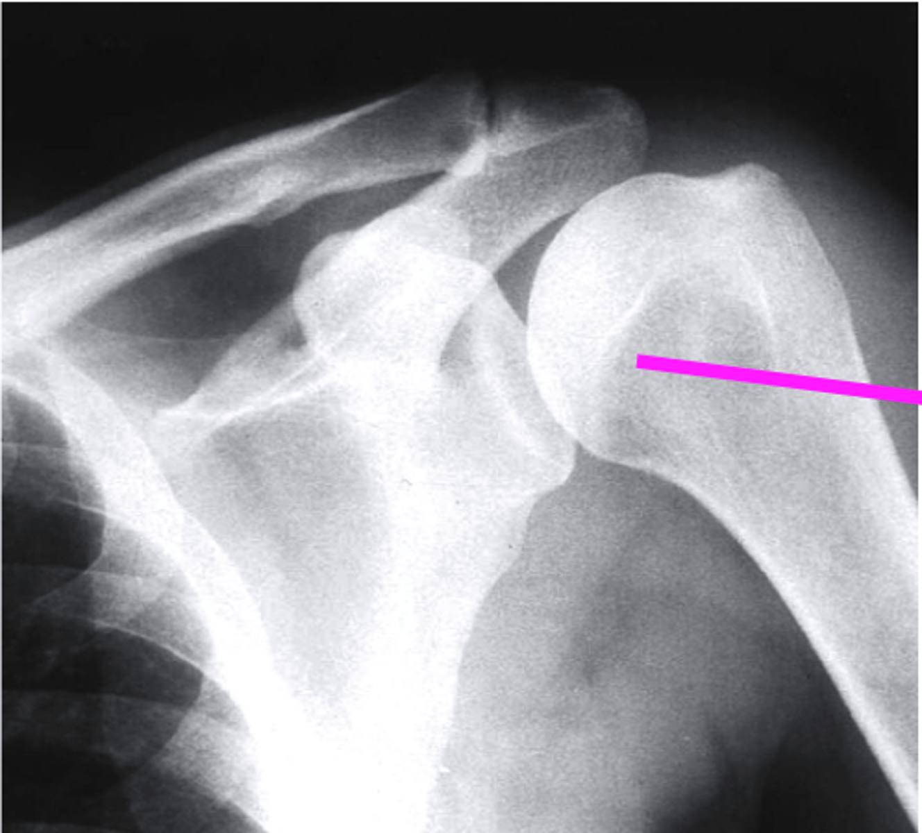 <p>what does the pink line point to?</p>