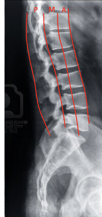 <ul><li><p>Anterior Column</p></li><li><p>Middle Column </p></li><li><p>Posterior Column</p></li></ul><p></p>