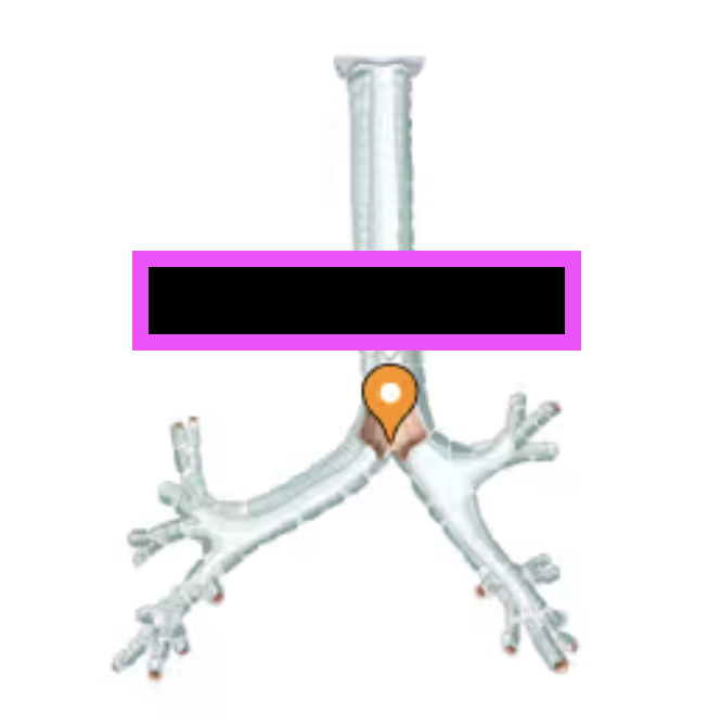 <p>(internal ridge where the trachea branches into left and right bronchi)&nbsp;</p>