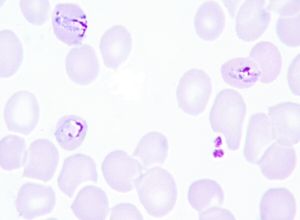 Late trophozoite plasmodium malariae