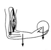 <p>based on this image, what type of force is being presented?</p>