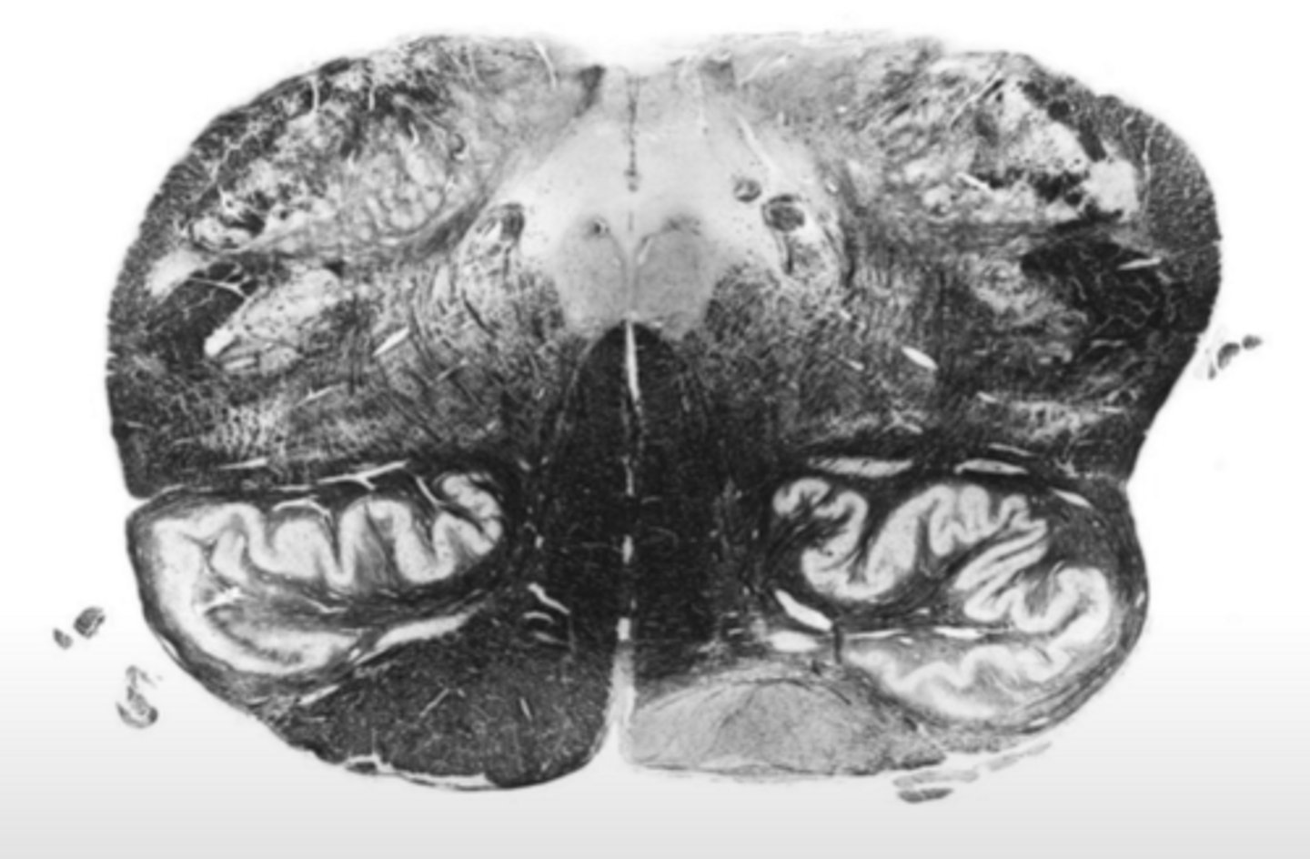 <p>ID the brainstem level</p>