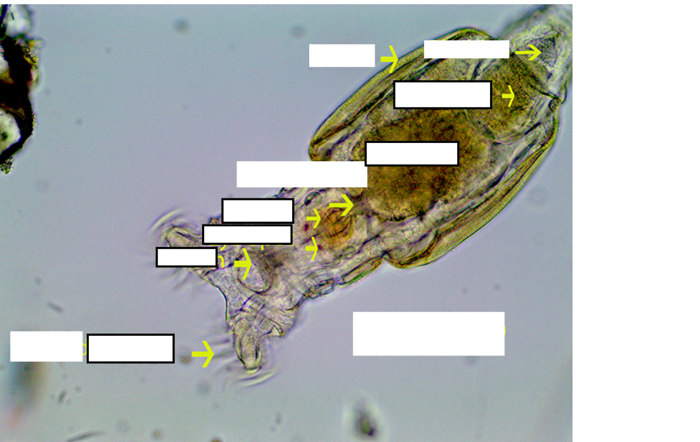 <p>Label and Name</p>