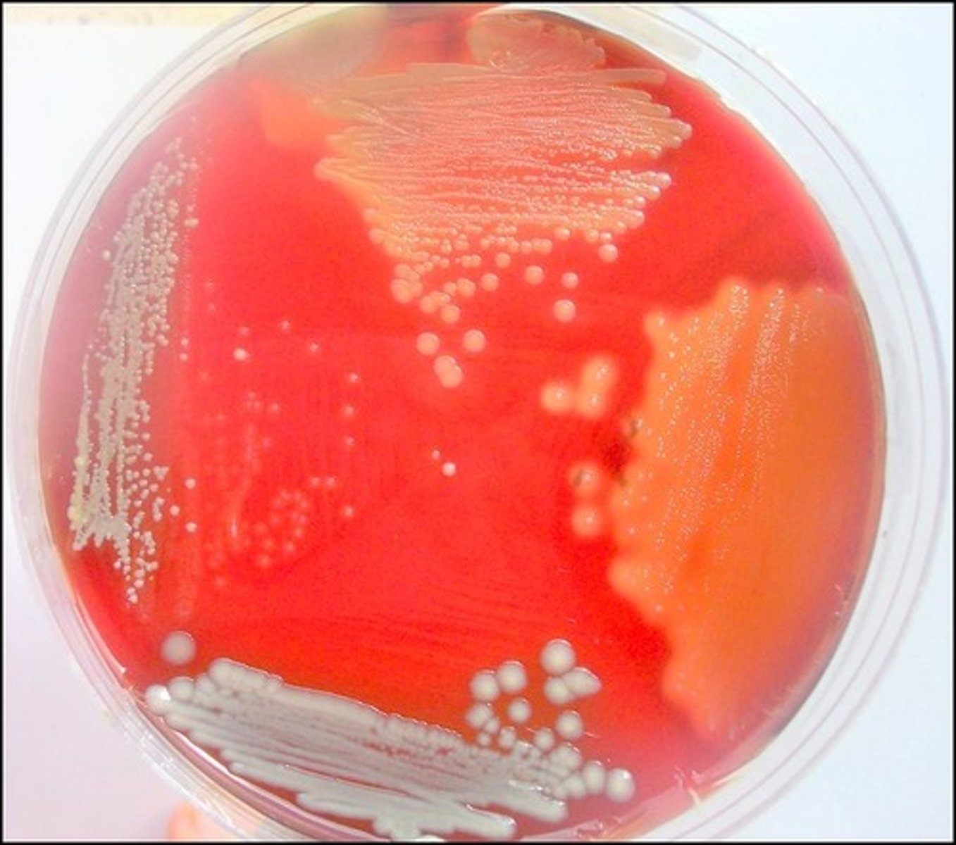 <p>Blood Agar</p><p>Selective:</p><p>Differential:</p><p>Dyes/Reagents:</p>