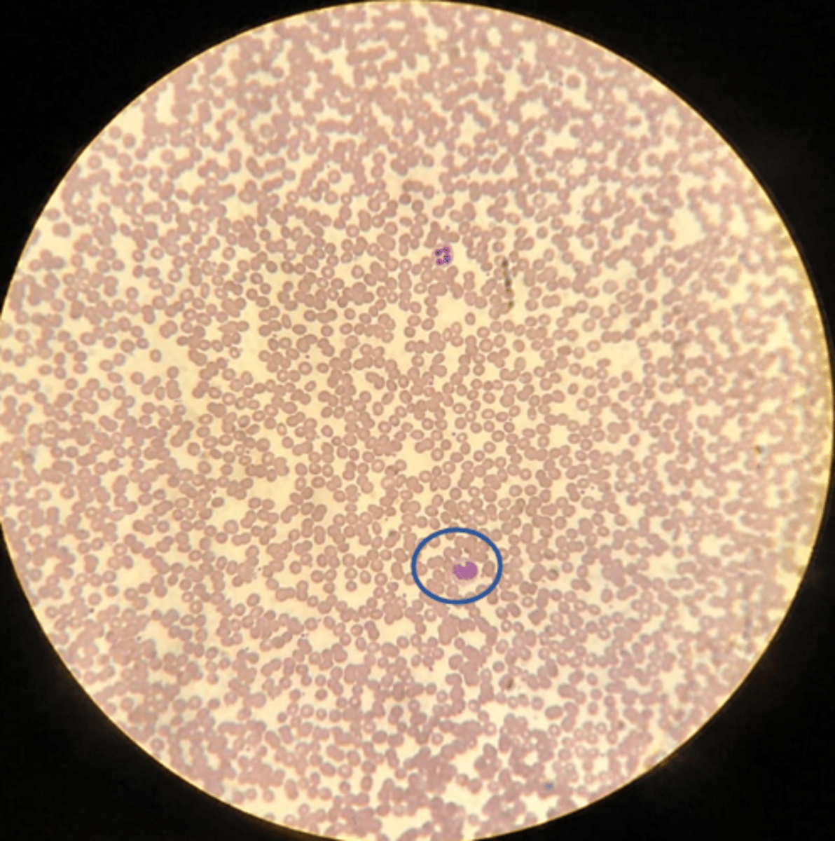 <p>What is the white blood cell shown?</p>