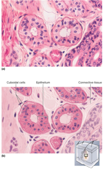 <p>Two or more layers of cells; surface cells square or round</p>