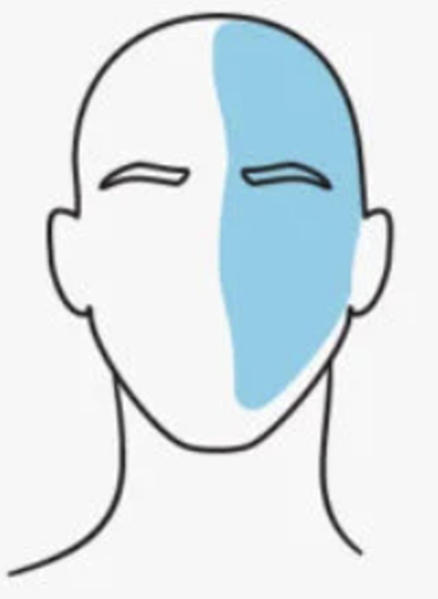 <p>either nausea/vomiting or photophobia/phonophobia, sinus symptoms, tinnitus, vertigo</p><p>- can be with or without aura</p>
