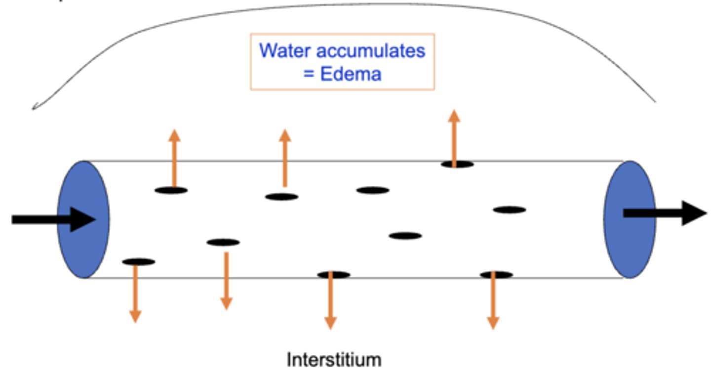 <p>water from the plasma is forced into the interstitium which can accumulate and cause edema</p>
