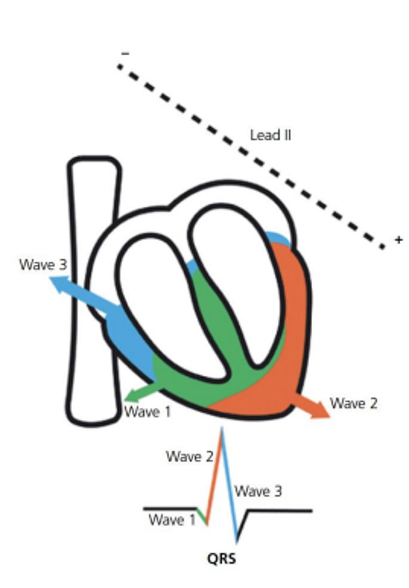 <p>Three; negative Q, positive R, negative S</p>