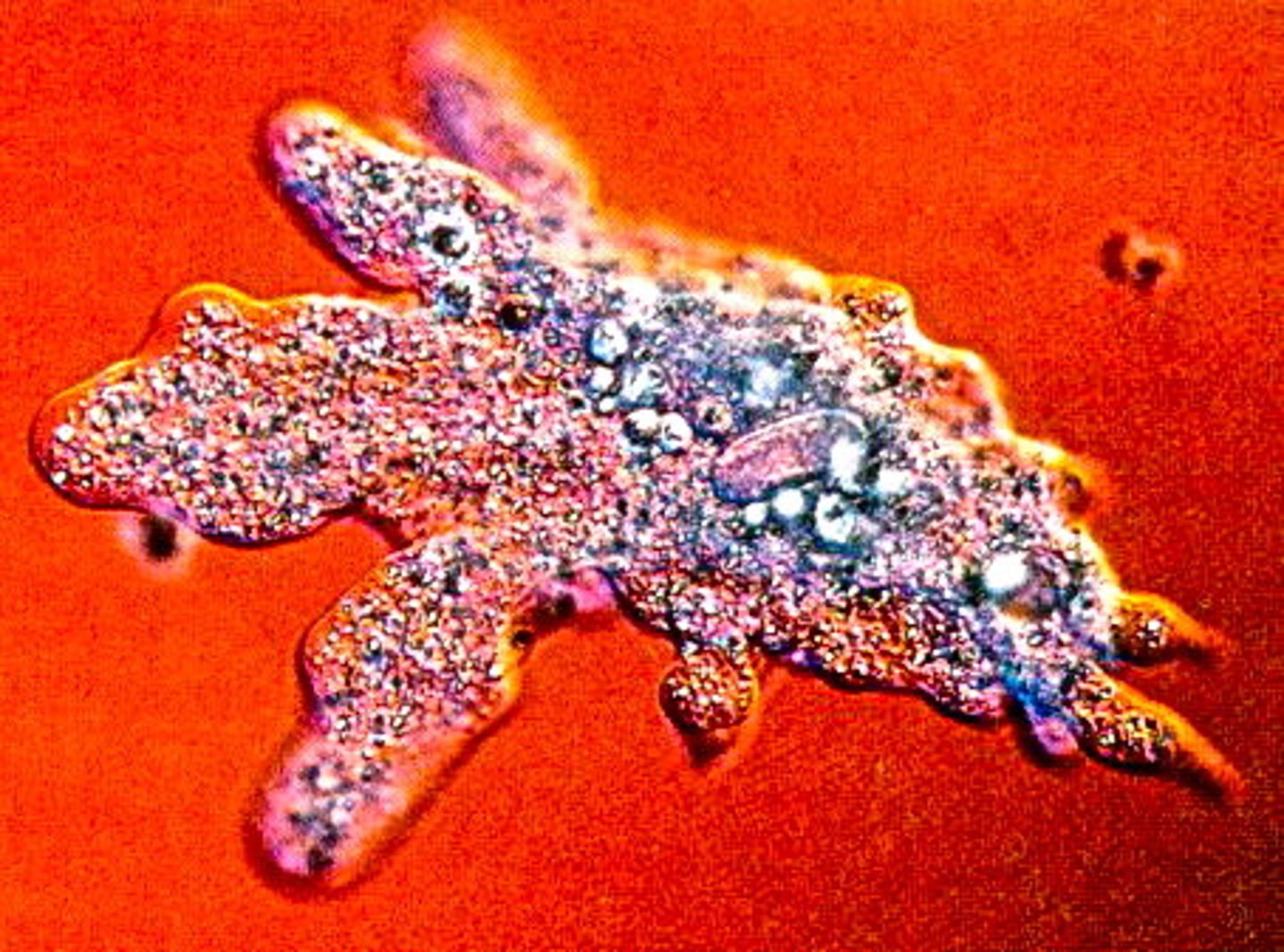 <p>finger-like extension, changes constantly, macrophages</p>