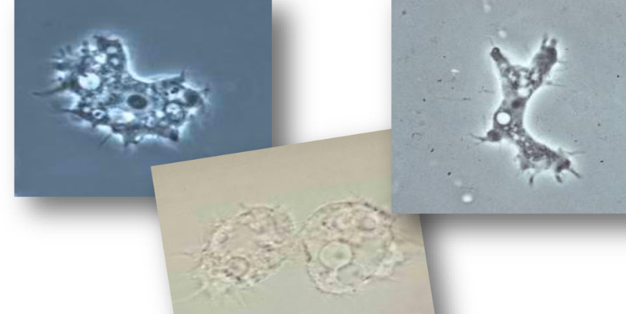 <p>Cyst and Trophozoite of </p>