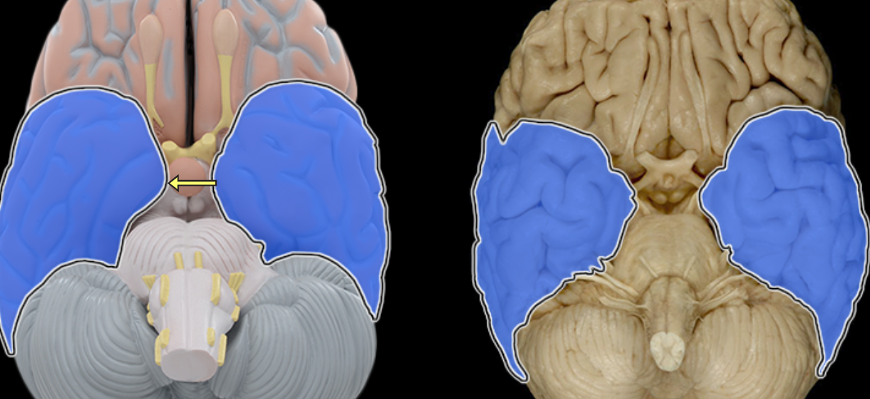 <p>Temporal bone</p>
