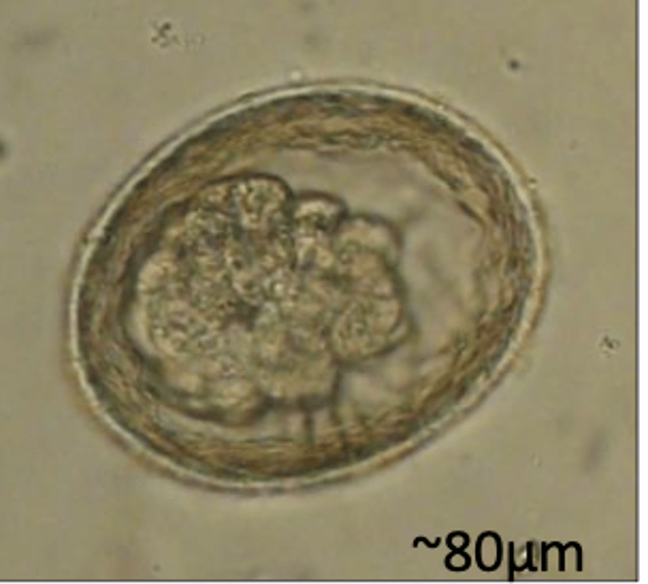 <p>Found in a cattery/kennels with dogs who are coughing and poor weight gain. What parasite species does this egg belong to?</p>