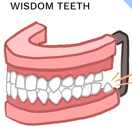 <p>Vestigial structure</p>