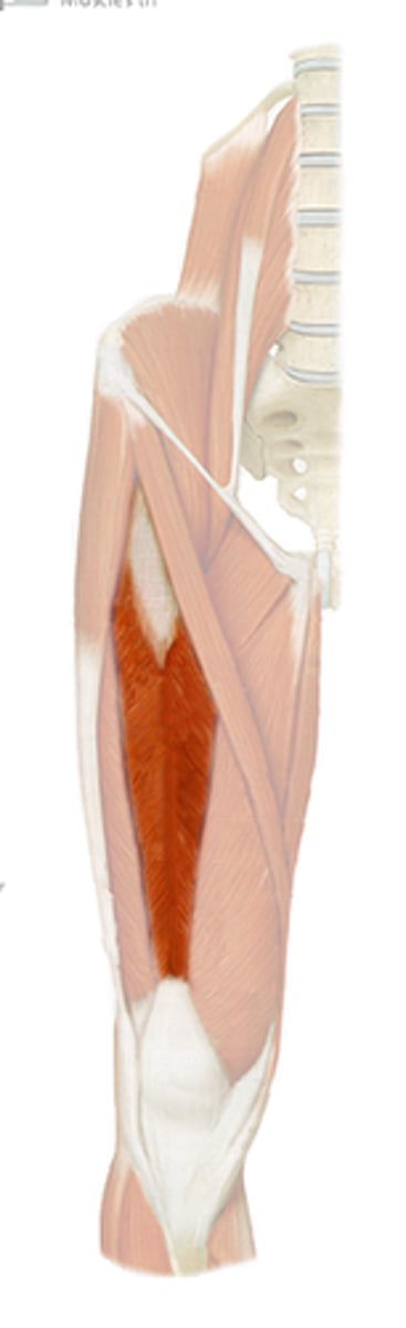 <p>origin: anterior inferior iliac spine, ilium above acetabulum</p><p>insertion: patella</p><p>action: extension of knee, flexion</p>