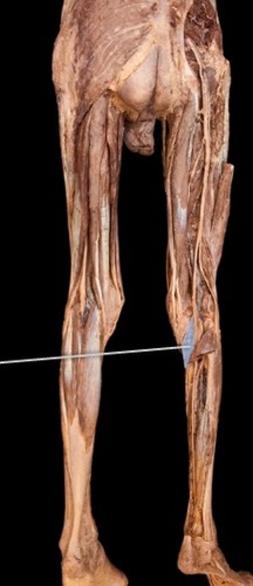 <p>What muscle is this?</p>