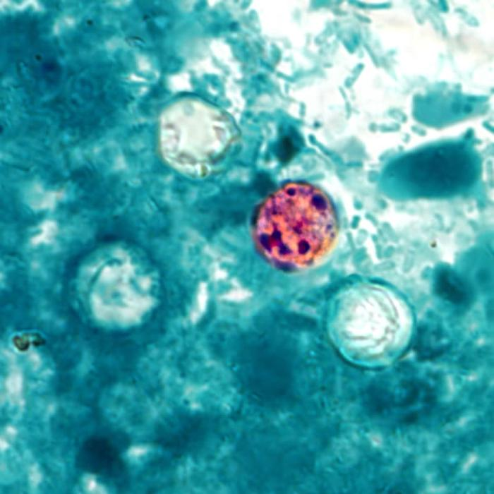 <p>in human and animal stool</p><p>abdomen pain, diarrhea, anorexia</p><p>worldwide, common in tropics, outbreaks in North America</p>