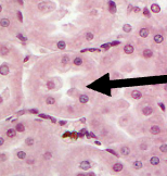 <p>What is on the arrow</p>