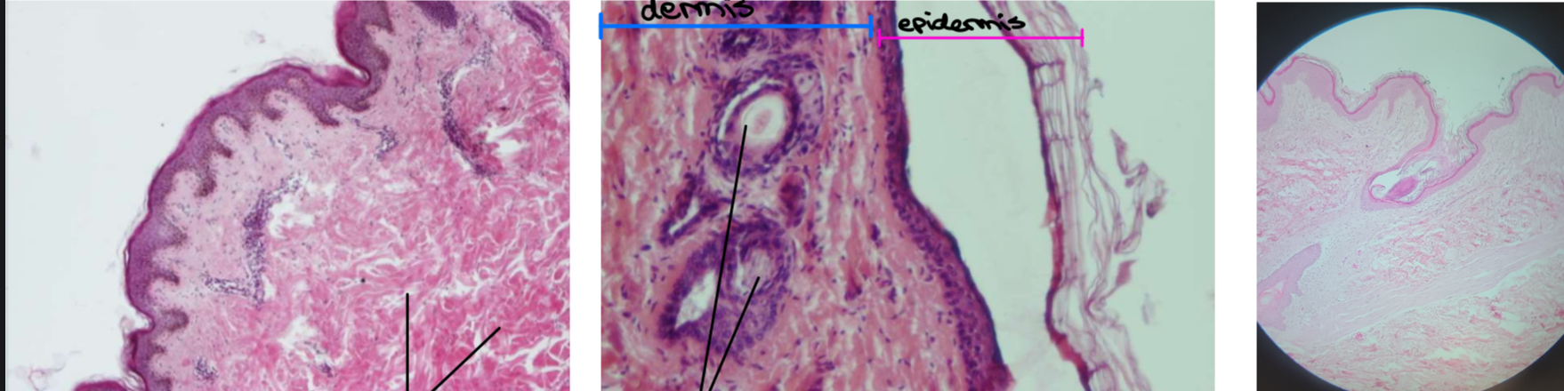 term image