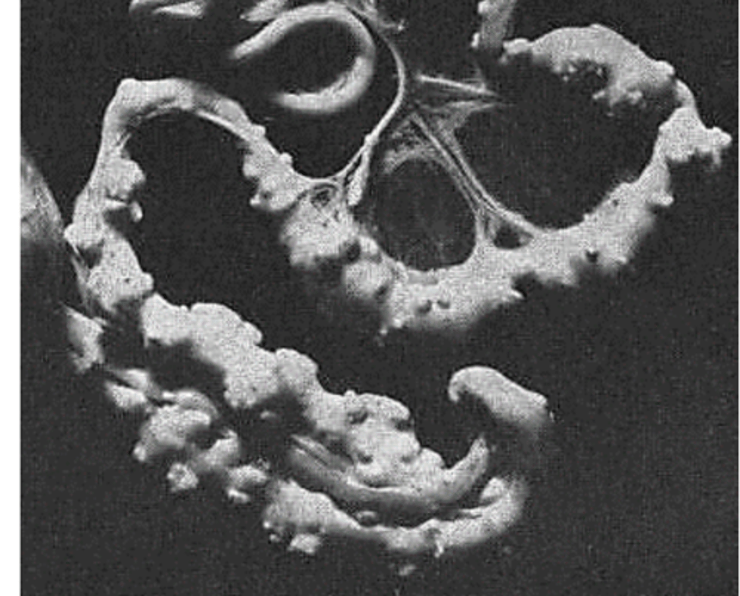 <p>Raillietina echinobothrida is causing nodules at the attachment site;</p>