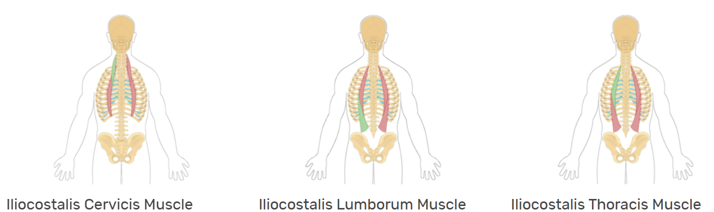 <p>Broad locational group knowledge expected*</p><p>-Iliocostalis Cervicis muscle</p><p>-Iliocostalis Thoracis muscle</p><p>-Iliocostalis Lumborum muscle</p><p>Most lateral to spine of erector spinae group</p><p>L: Iliac crest, sacrum → Ribs and transverse process of cervical vertebrae </p><p>F: Spine; extension, flexion and posture maintenance </p><p><strong>I </strong>I I (spine) I I <strong>I</strong></p>