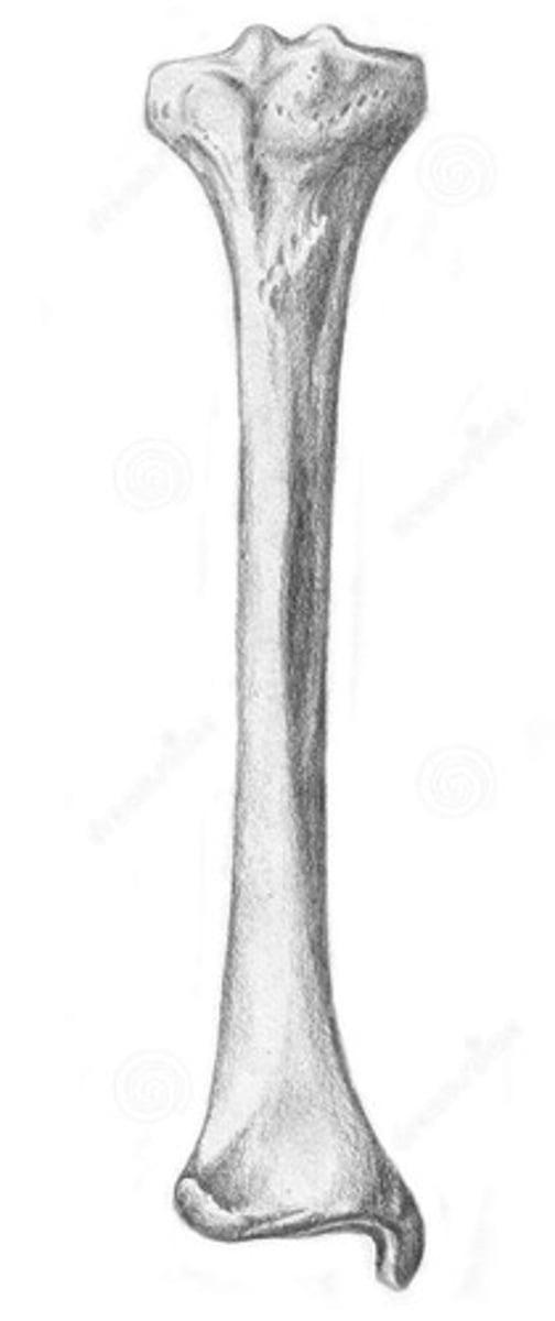 <p>ID bone</p>