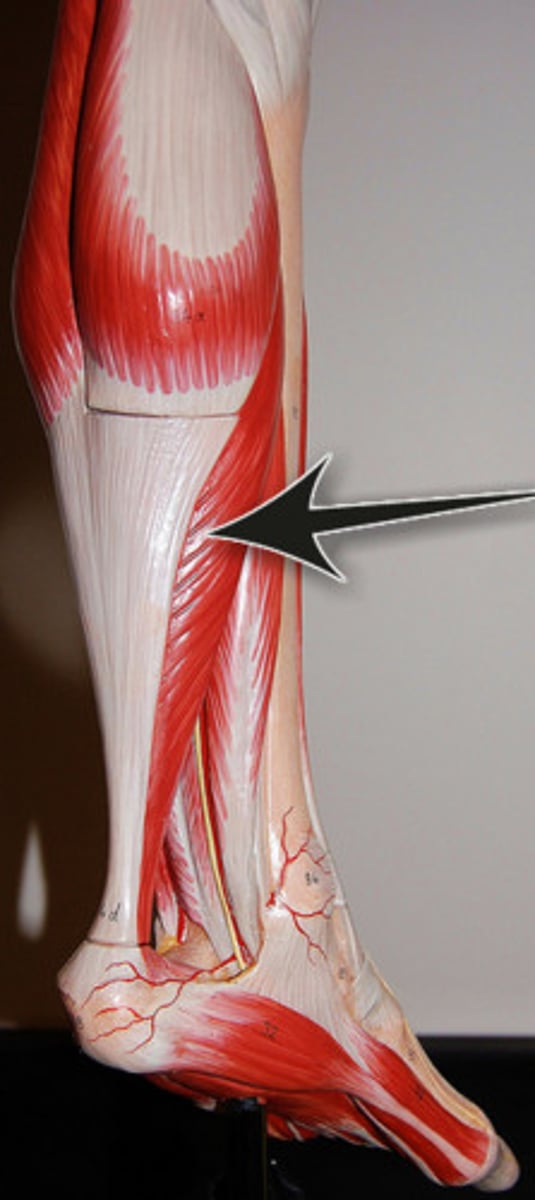 <p>Identify what the arrow is pointing to</p>