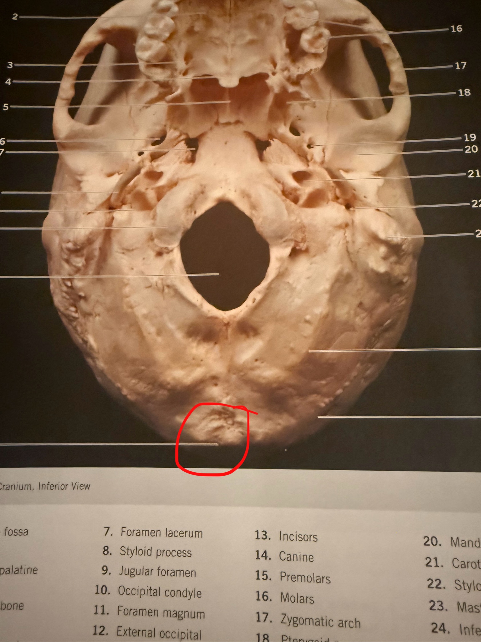 term image
