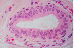 <ul><li><p>two layers of cube cells </p></li><li><p>found in ducts of large glands and ovarian follicles </p></li></ul><p></p>