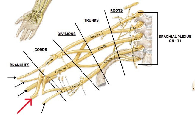 <p>Which nerve of the brachial plexus is:</p><ul><li><p>Lateral and median cords</p></li></ul><p></p>