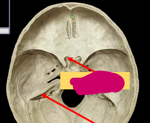 <p>What feature of the skull is this?</p>