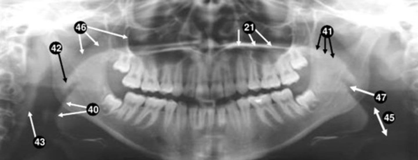 <p>21</p>