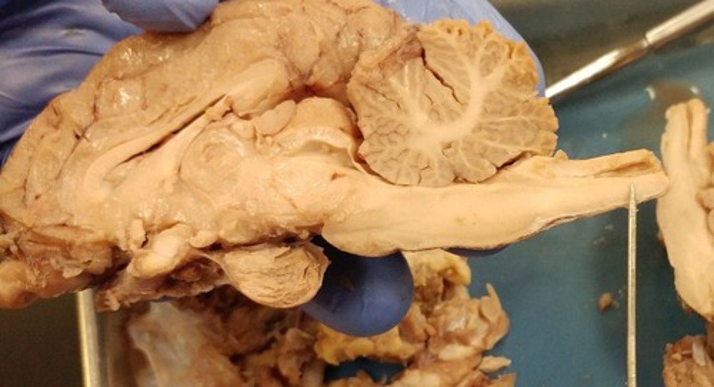 <p>- Hollow tube in spinal cord</p><p>- Continuous with ventricles</p>