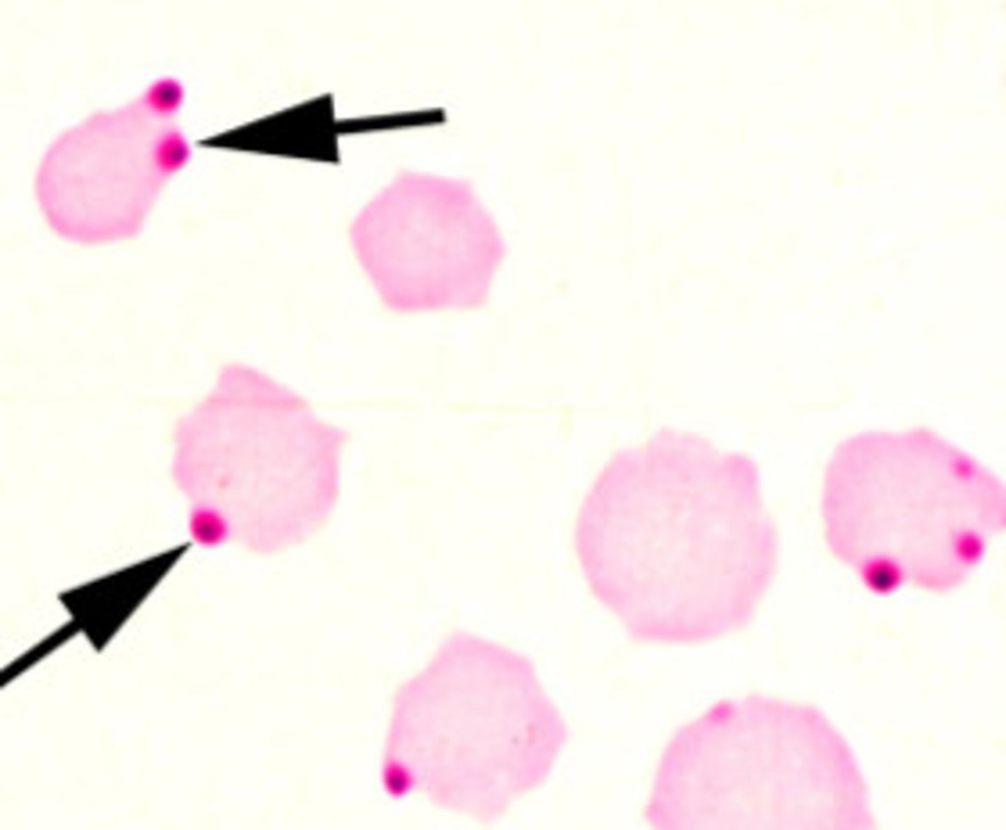 <p>Gram negative intracellular (platelets or neutrophils)</p><p>Affects the hematologic and musculoskeletal systems</p><p>Causes fever, joint pain, low platelets</p><p>Tick-borne</p>