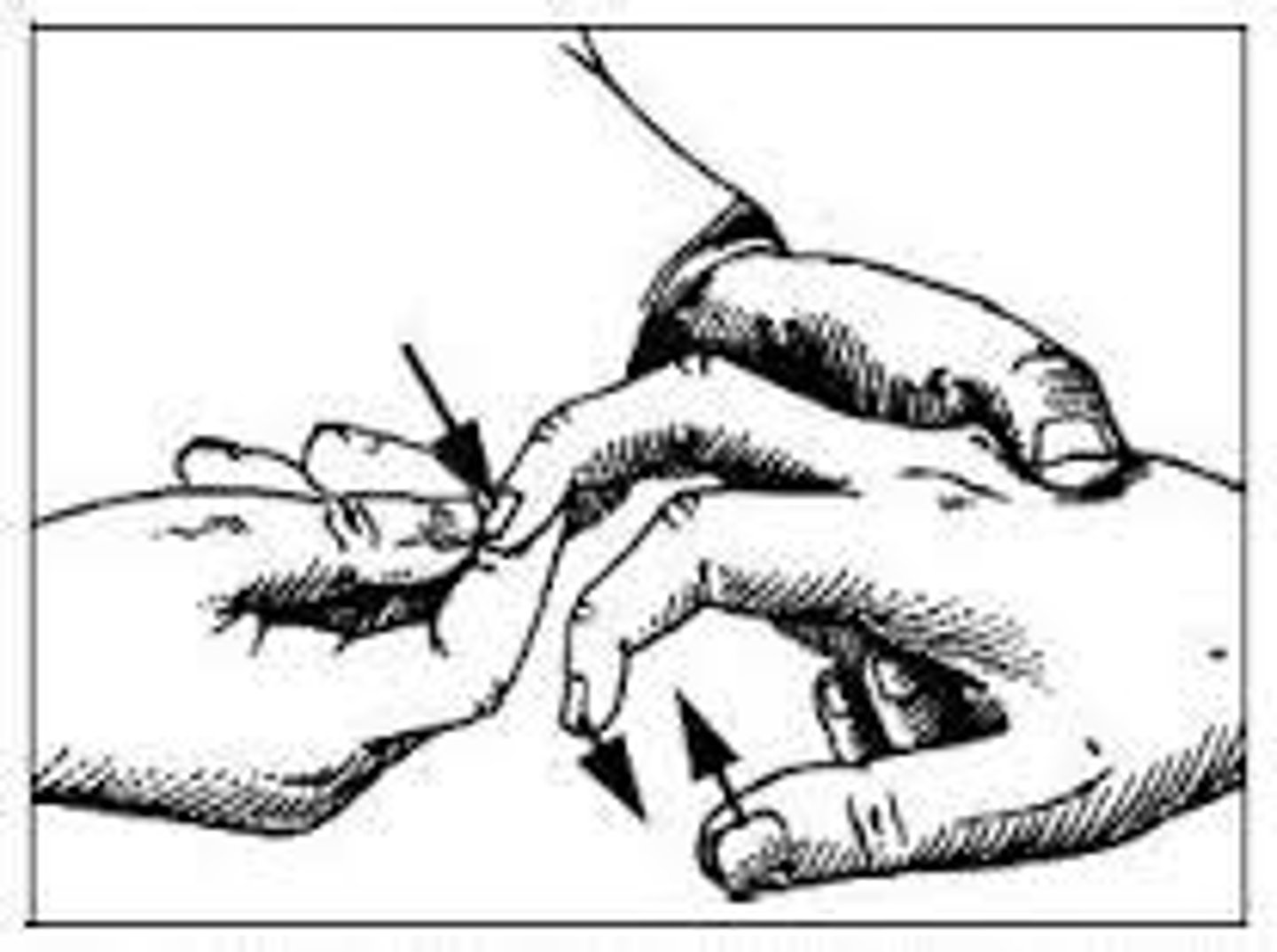 <p>Testing Procedure:</p><p>1. patient is sitting or standing</p><p>2. stabilize middle finger proximal to DIP</p><p>3. flick middle finger nail</p><p>Positive Sign: adduction + opposition of thumb + slight flexion of fingers</p>