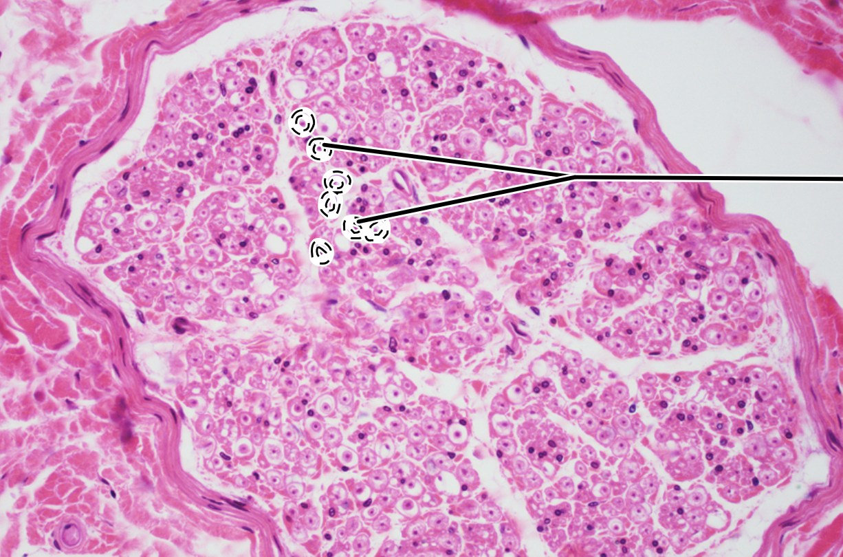 <p>delicate connective tissue around individual nerve fibers in nerve</p>