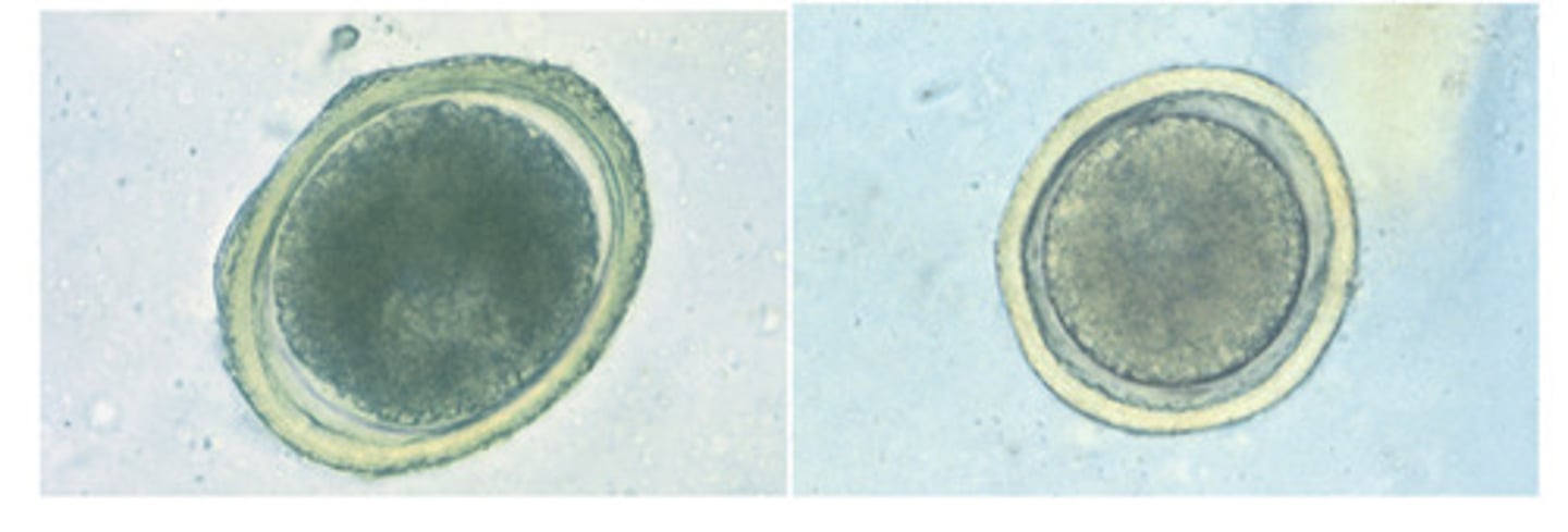 <p>While these 2 nematode ova are similar in appearance, they differ in size and definitive host species. The larger of the 2 ova, seen on the left is the ova of..</p>