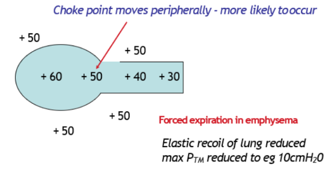 <ul><li><p><span>Patients with emphysema, have a reduced elastic recoil as lung tissue is damaged.</span></p></li><li><p><span>Lose the ability to generate a high P<sub>A</sub>.</span></p><ul><li><p><span>Max transmural pressure is lower e.g. 10cmH<sub>2</sub>O&nbsp;</span></p></li></ul></li><li><p><span>Therefore, it is more likely they will get choke point forming in more peripheral (lower) airways limits ability to generate a high flow.&nbsp;</span></p></li></ul>