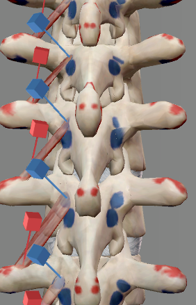 <p>Origin: Transverse process of each thoracic vertebra</p><p>Insertion: Spinous process of the vertebra above each origin</p><p>Innervation: Cervical, thoracic, and lumbar nerves (posterior branch)</p><p>Action: Rotation of the thoracic spine; extension of the spine; contralateral rotation of the head</p>