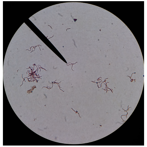 <p>What disease is this species an agent for?</p>