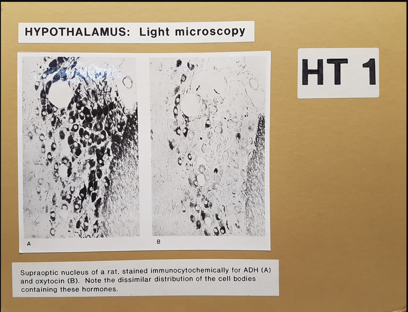 <ul><li><p>immunocytochemically stained for ADH and oxytocin</p></li></ul><p></p>