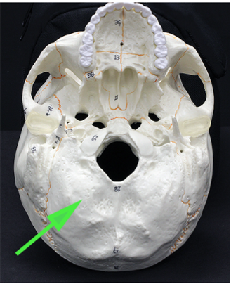 <p>What is the bone marked by the green arrow?</p>